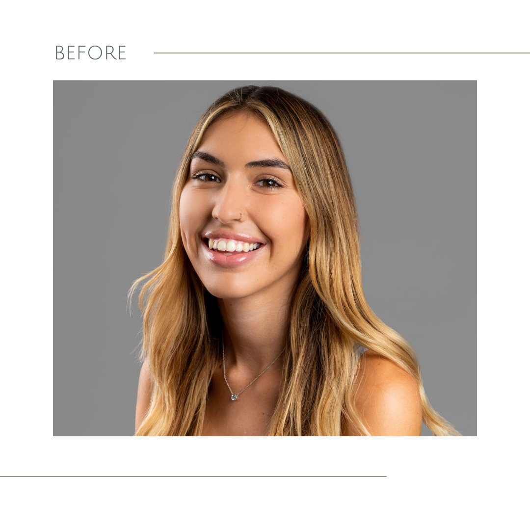 San Diego Lash Kit